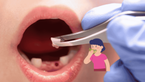 Bad Breath