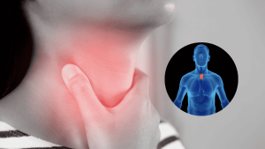 Pill-induced esophagitis medication-esophagitis-risk