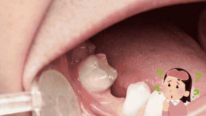 missing teeth